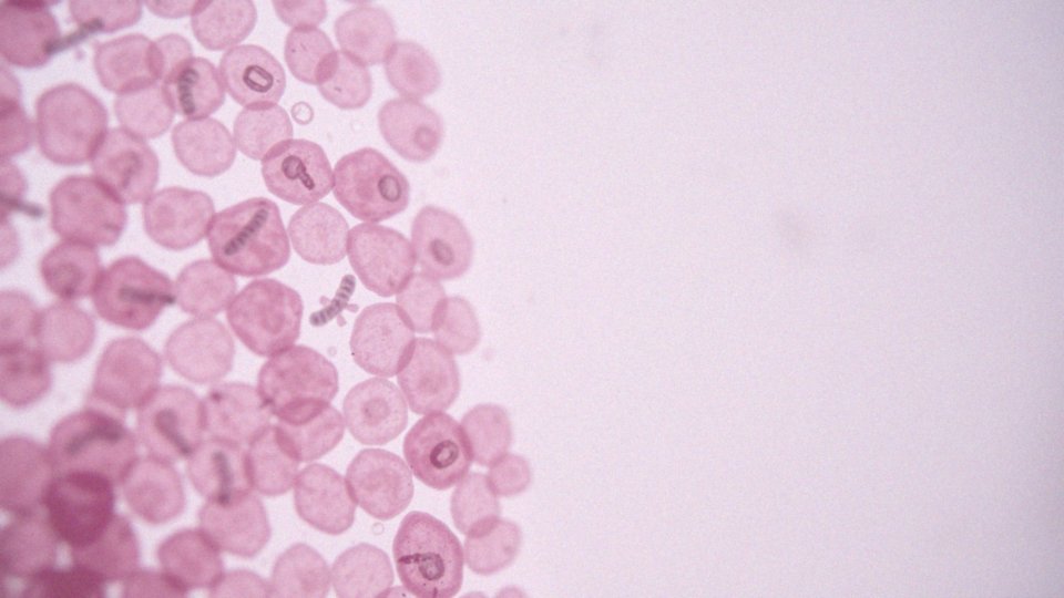 Czy zakażenie Helicobacter pylori zawsze prowadzi do choroby wrzodowej?